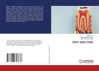 Produktbild: Post and Core