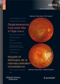 Produktbild: D&eacute;g&eacute;n&eacute;rescence maculaire li&eacute;e &agrave; l'&acirc;ge (DMLA) / Myopie et &eacute;tiologies de