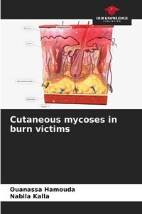 Produktbild: Cutaneous mycoses in burn victims