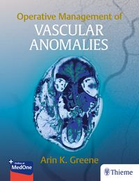Produktbild: Operative Management of Vascular Anomalies