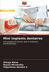 Produktbild: Mini implants dentaires