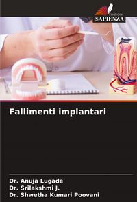 Produktbild: Fallimenti implantari