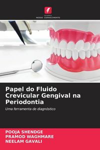Produktbild: Papel do Fluido Crevicular Gengival na Periodontia
