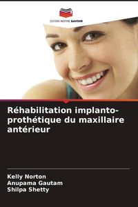 Produktbild: R&eacute;habilitation implanto-proth&eacute;tique du maxillaire ant&eacute;rieur