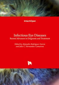 Produktbild: Infectious Eye Diseases