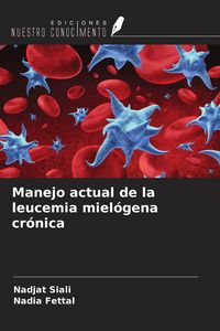 Produktbild: Manejo actual de la leucemia miel&oacute;gena cr&oacute;nica