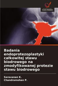 Produktbild: Badania endoprotezoplastyki ca&iquest;kowitej stawu biodrowego na zmodyfikowanej protezie stawu biodrowego