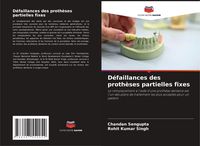 Produktbild: D&eacute;faillances des proth&egrave;ses partielles fixes