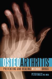 Produktbild: Osteoarthritis