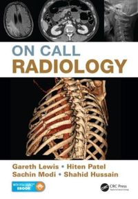 Produktbild: On Call Radiology