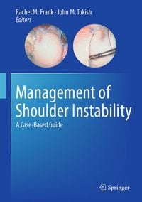 Produktbild: Management of Shoulder Instability