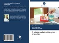 Produktbild: Prothetische Betrachtung der Implantate