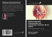 Produktbild: Edema macular relacionado con oclusiones venosas de la retina