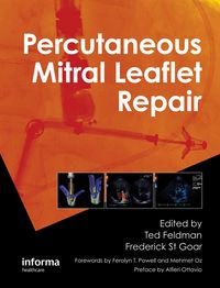 Produktbild: Percutaneous Mitral Leaflet Repair