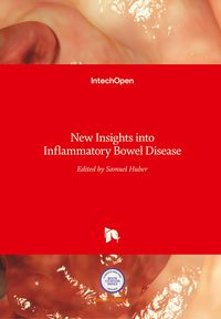 Produktbild: New Insights into Inflammatory Bowel Disease