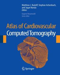 Produktbild: Atlas of Cardiovascular Computed Tomography