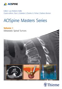 Produktbild: AOSpine Masters Series Volume 1: Metastatic Spinal Tumors