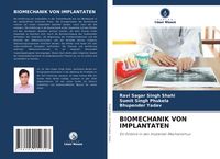 Produktbild: Biomechanik von Implantaten