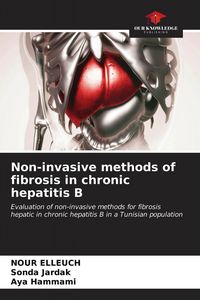 Produktbild: Non-invasive methods of fibrosis in chronic hepatitis B