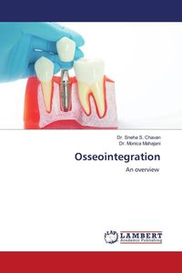 Produktbild: Osseointegration