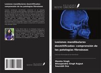 Produktbild: Lesiones mandibulares desmitificadas: comprensi&oacute;n de las patolog&iacute;as fibro&oacute;seas