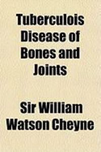 Produktbild: Tuberculois Disease of Bones and Joints