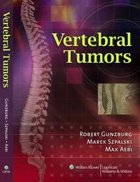 Produktbild: Vertebral Tumors