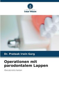 Produktbild: Operationen mit parodontalem Lappen