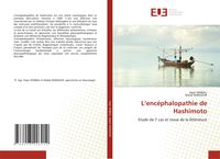 Produktbild: L'enc&eacute;phalopathie de Hashimoto