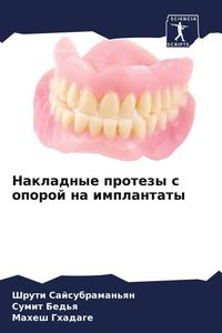 Produktbild: Nakladnye protezy s oporoj na implantaty