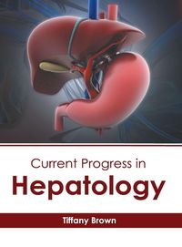 Produktbild: Current Progress in Hepatology