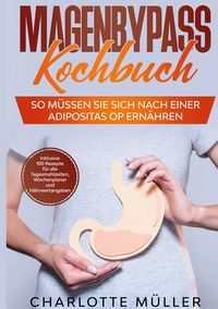 Produktbild: Magenbypass Kochbuch