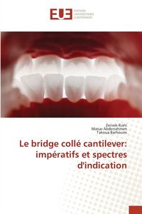 Produktbild: Le bridge coll&eacute; cantilever: imp&eacute;ratifs et spectres d'indication