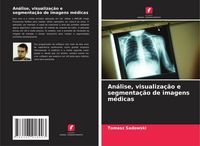 Produktbild: An&aacute;lise, visualiza&ccedil;&atilde;o e segmenta&ccedil;&atilde;o de imagens m&eacute;dicas