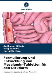 Produktbild: Formulierung und Entwicklung von Mesalamin-Tabletten f&uuml;r den Dickdarm