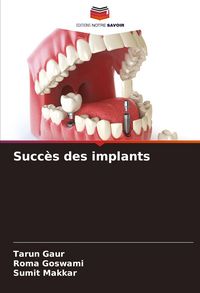 Produktbild: Succ&egrave;s des implants
