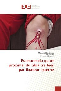 Produktbild: Fractures du quart proximal du tibia trait&eacute;es par fixateur externe