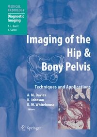 Produktbild: Imaging of the Hip & Bony Pelvis