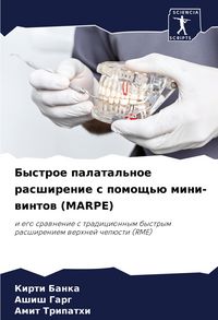 Produktbild: Bystroe palatal'noe rasshirenie s pomosch'&uuml; mini-wintow (MARPE)