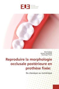 Produktbild: Reproduire la morphologie occlusale post&eacute;rieure en proth&egrave;se fix&eacute;e: