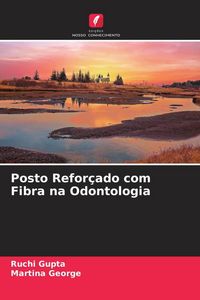 Produktbild: Posto Refor&ccedil;ado com Fibra na Odontologia