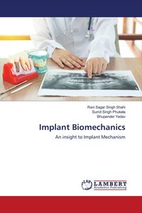 Produktbild: Implant Biomechanics