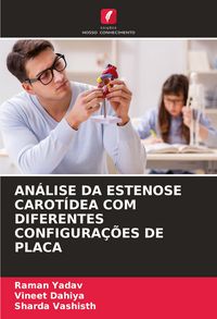 Produktbild: An&aacute;lise Da Estenose Carot&iacute;dea Com Diferentes Configura&ccedil;&otilde;es De Placa