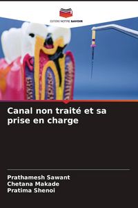 Produktbild: Canal non trait&eacute; et sa prise en charge