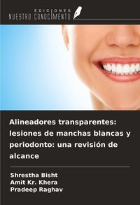 Produktbild: Alineadores transparentes: lesiones de manchas blancas y periodonto: una revisi&oacute;n de alcance