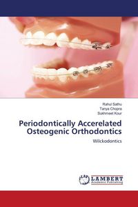 Produktbild: Periodontically Accerelated Osteogenic Orthodontics