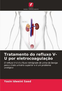 Produktbild: Tratamento do refluxo V-U por eletrocoagula&ccedil;&atilde;o