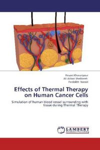 Produktbild: Khavaripour, H: Effects of Thermal Therapy on Human Cancer C