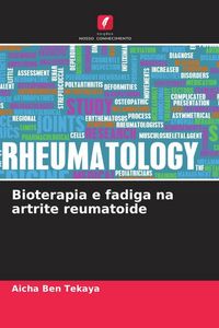 Produktbild: Bioterapia e fadiga na artrite reumatoide
