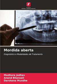 Produktbild: Mordida aberta